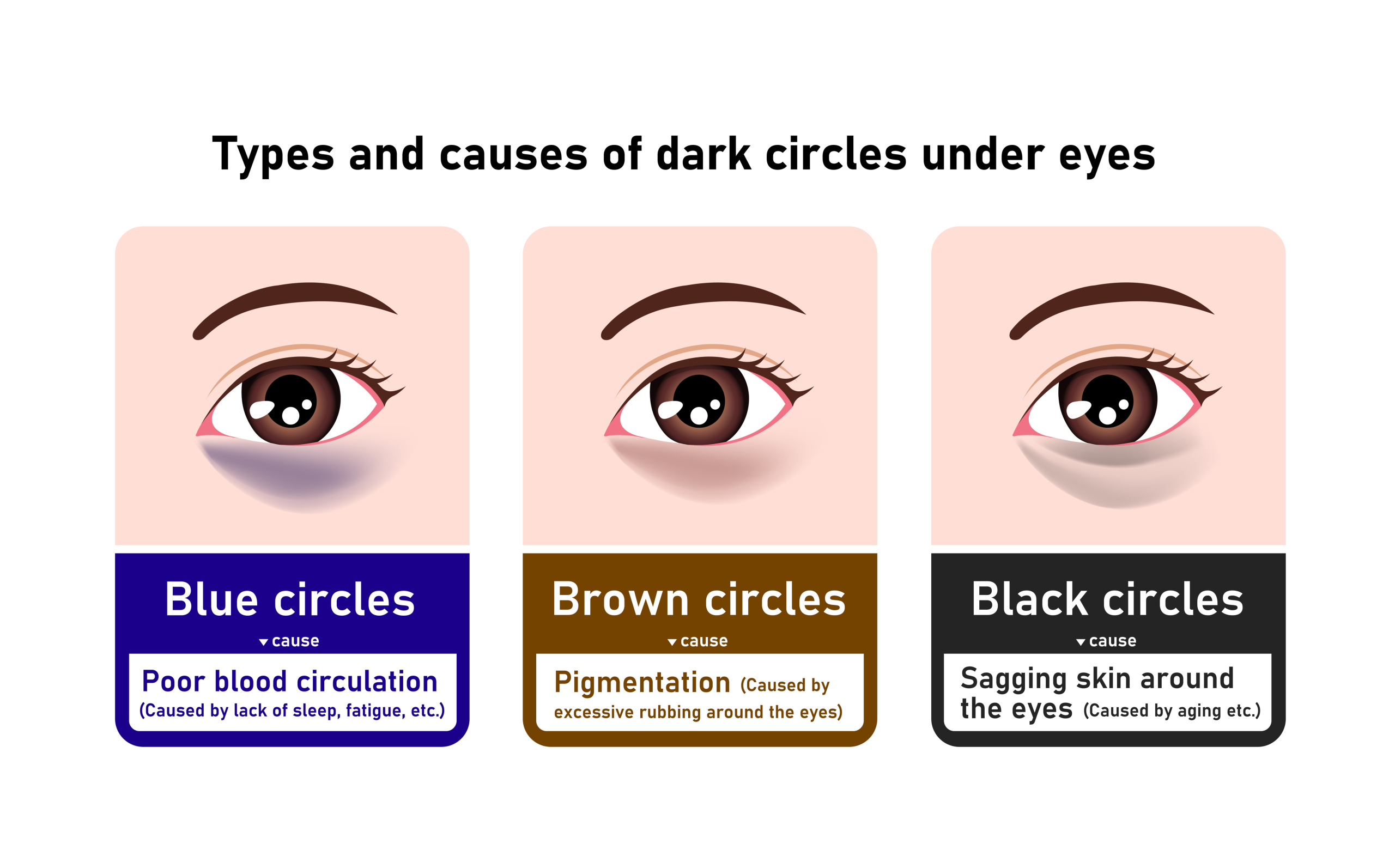Conquering Those Under Eye Blues A Guide To Treating Dark Circles And 